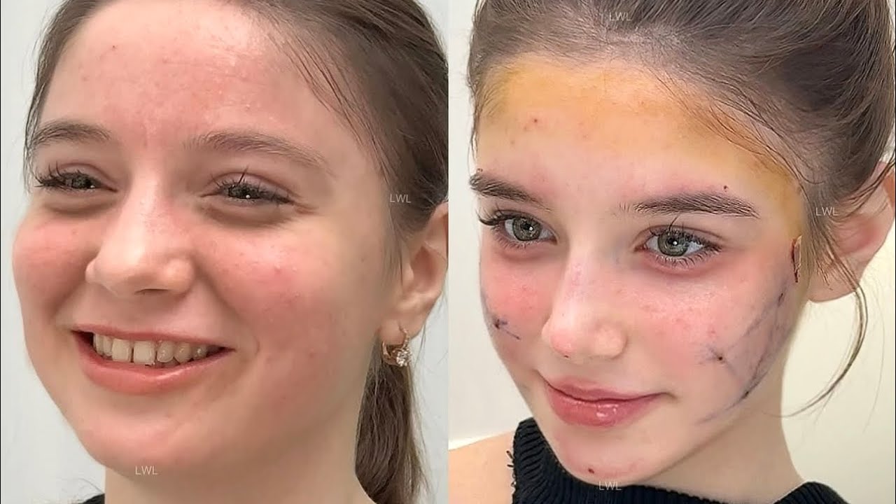 drastically beautifying and reconstructing your face until you reach your full potential 💉🎀