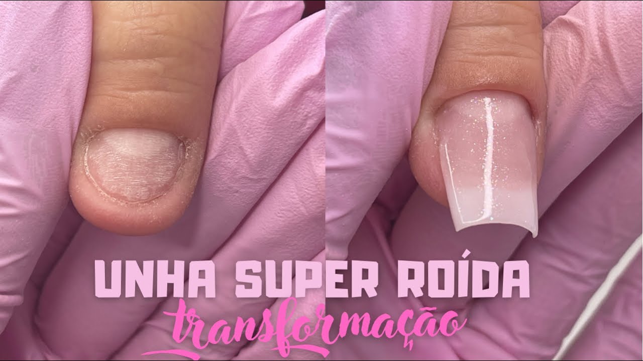 unha SUPER ROÍDA!!! Alongamento em fibra de vidro