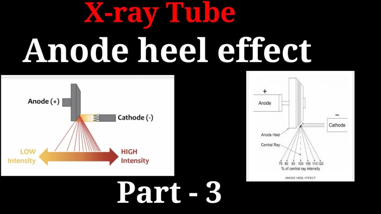 PPT - Introduction of Radiographic Technology PowerPoint Presentation, free  download - ID:1307807