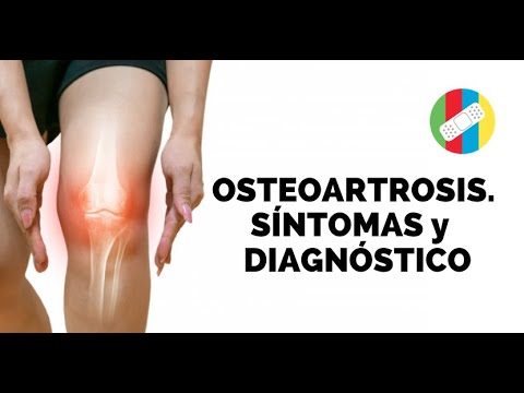 Vídeo: Osteoartritis: Síntomas, Diagnóstico