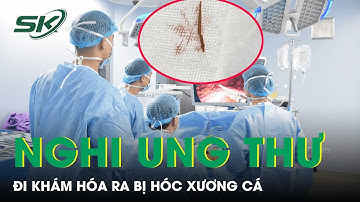 Nghi Ung Thư, Đi Khám Hóa Ra Bị Hóc Xương Cá I SKĐS