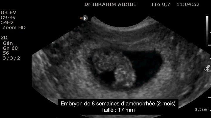 Embryon 8 semaines de grossesse
