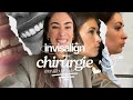 Chirurgie maxillofaciale et invisalign 2 ans plus tard