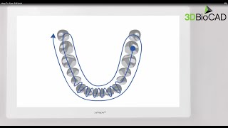 3D BioCAD - TRIOS 3 Full Arch Scan Path Navigation