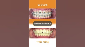 Hành trình LỘT XÁC của Tuyết Trinh