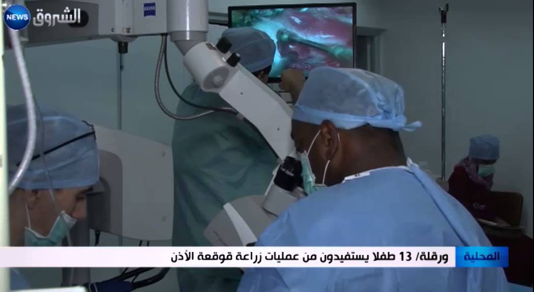 ورقلة: 13 طفلا يستفيدون من عمليات زراعة قوقعة الأذن