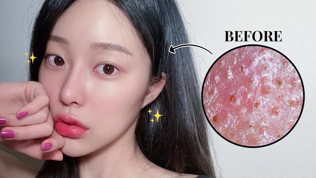 YouTube thumbnail, 민카롱