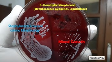 Beta-haemolytic colonies of Staphylococcus aureus and Streptococci on Blood agar demonstration