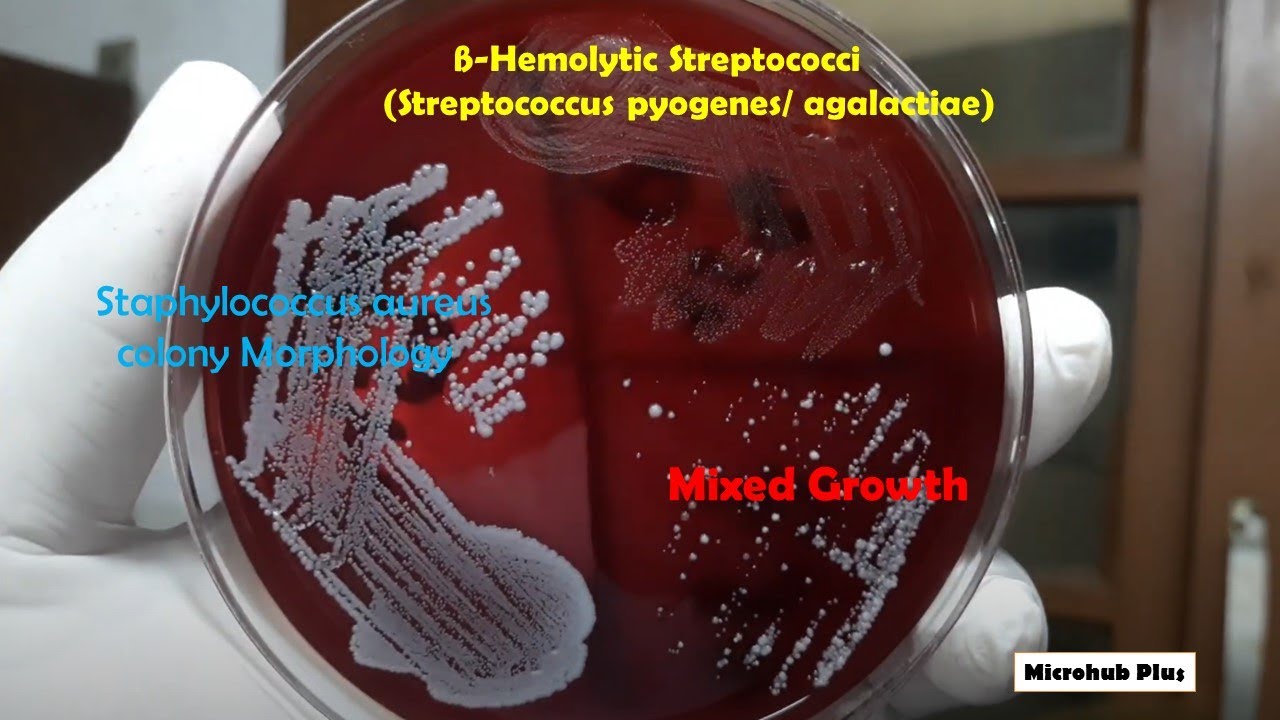 4 blood agar and hemolysis and mac-conkey.ppt