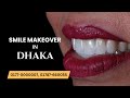 Digital Smile Makeover in Dhaka | Step by Step at LASER DENTAL