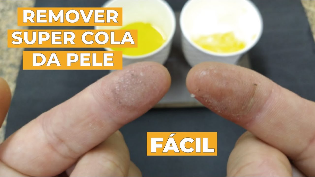 COMO REMOVER SUPER BONDER DOS DEDOS - MUITO FÁCIL !!! - YouTube