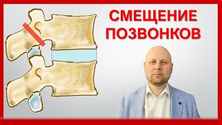 Узнайте правду о смещениях позвоночника