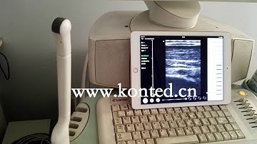 2017 New Wireless Linear Probe 10/12Mhz