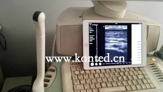 2017 New Wireless Linear Probe 10/12Mhz