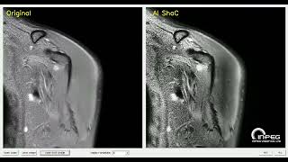 AI Medi ShaC General Electric 3T O MRI v1 2