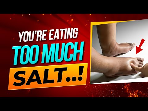 10 WORST Side Effects of Eating TOO MUCH Salt [Hidden Dangers You Never Knew]