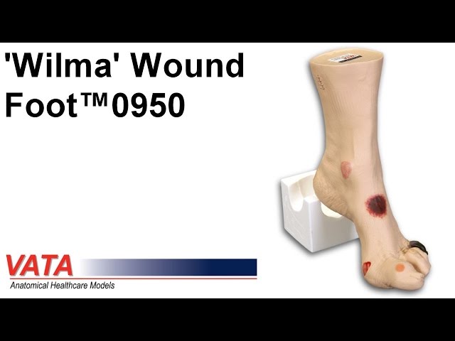 Wilma Wound Foot&trade;, 1017978 [w46516], Cuidado dec&uacute;bito (Video)
