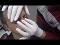 ASMR TURKISH BARBER💈 NECK-EAR CRACK=SKIN CARE=RAZOR BEARD SHAVE=NOSE-EAR WAX=head,ear,sleep massage