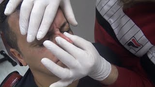 ASMR TURKISH BARBER💈 NECK-EAR CRACK=SKIN CARE=RAZOR BEARD SHAVE=NOSE-EAR WAX=head,ear,sleep massage