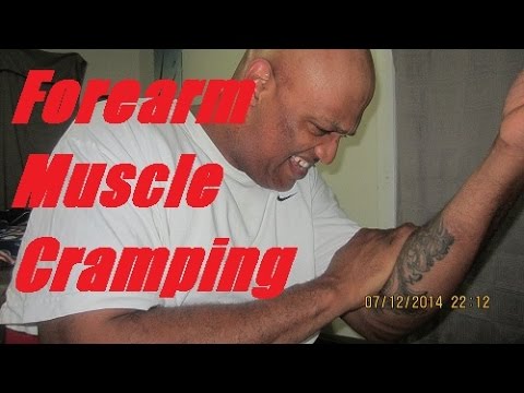 Forearm Muscle Cramping : Fasciculation Syndrome - YouTube