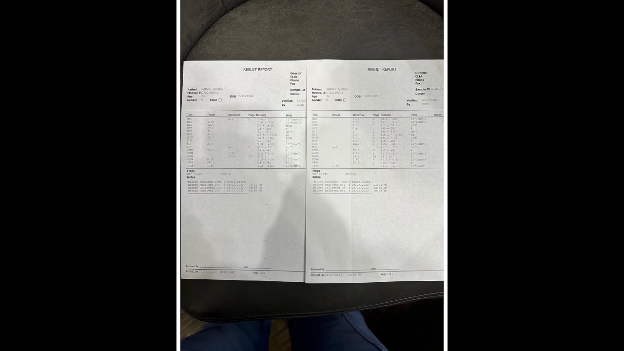 How to make Platelet Rich Plasma (PRP) with no Kit!  #prp Video (From 120cc blood to 6cc PRP)