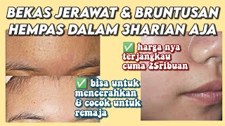 Skincare untuk Bruntusan & Bekas Jerawat (Otw Glowing) ✨