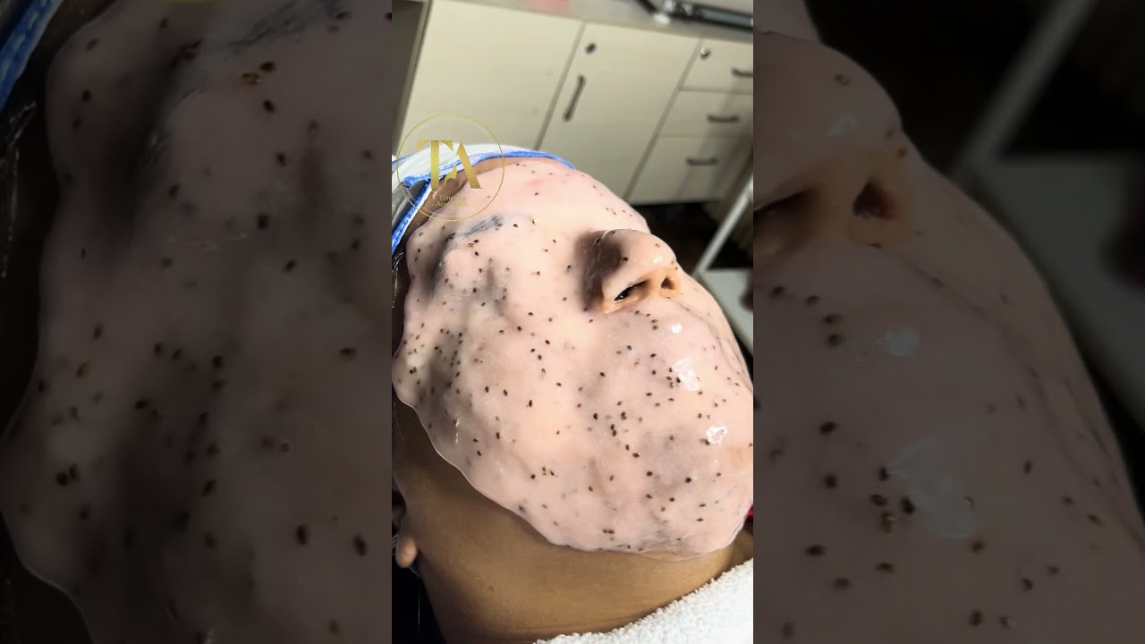 🌿✨ Your skin’s new best friend: Timeless Aesthetics CBD Jelly Mask! 🌟