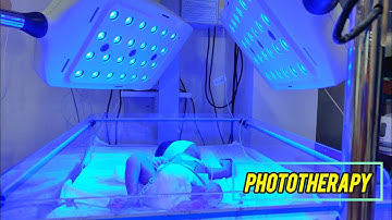 Phototherapy For Newborn Baby | Jaundice Treatment | Nicu