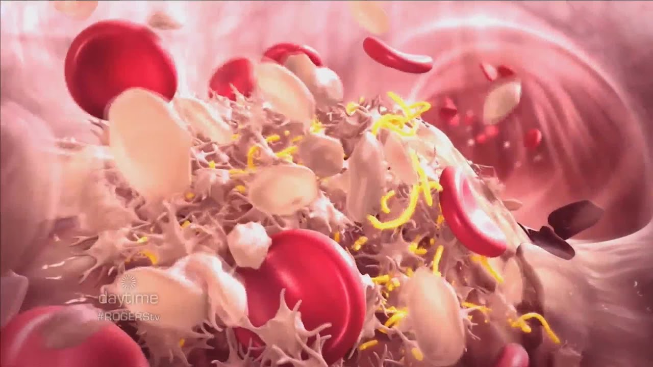 Preventing Heart Disease & Heart Attacks