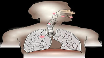 ¿Qué es bueno para abrir las vías respiratorias?