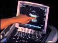 How to: Pneumothorax Evaluation with Ultrasound