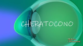 CHERATOCONO: grazie alla innovativa tecnologia 