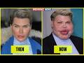 35 Stars Who Completely Ruined Their Faces With Plastic Surgery Disasters | Then and Now Photos 2026