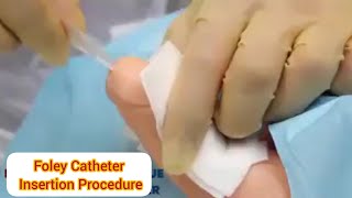 Male Foley Catheter Insertion Procedure طريقة تركيب القسطرة البوليه للرجال