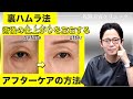 【裏ハムラ】術後のアフターケア