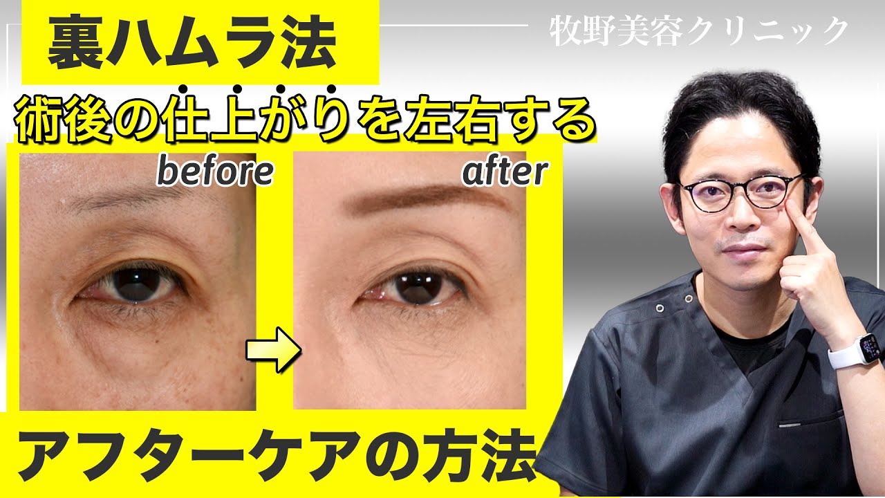 【裏ハムラ】術後のアフターケア