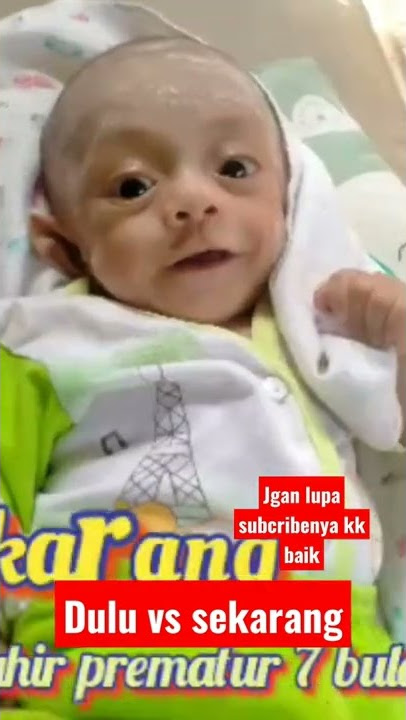 lahir prematur 7 bulan 🥺😭😢 aku yang dulu vs sekarang
