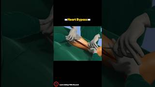 Heart Bypass Surgery Procedure - 3D video _ #cardiology #short Resimi