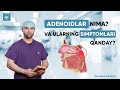 Adenoid nima va ularning simptomlari   dr asqar ashurov