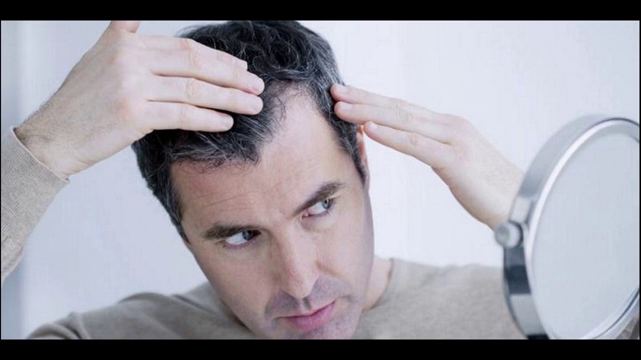 What Causes White Hair Is Hydrogen Peroxide Free Radicals YouTube