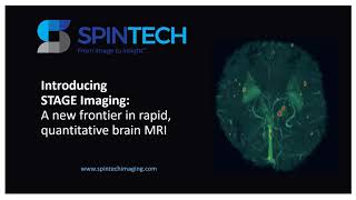 Introducing STAGE Imaging: Rapid, Quantitative, Multi-Contrast MRI