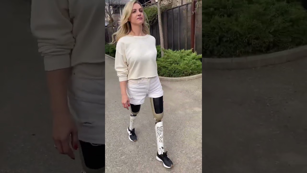 Двигайся только вперед! Фантастическая походка у девушки на двух протезах #shorts