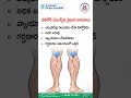 Varicose Veins Main Causes | Treatment Range Hospital #ytshorts #ytshots #varicoseveins #yt