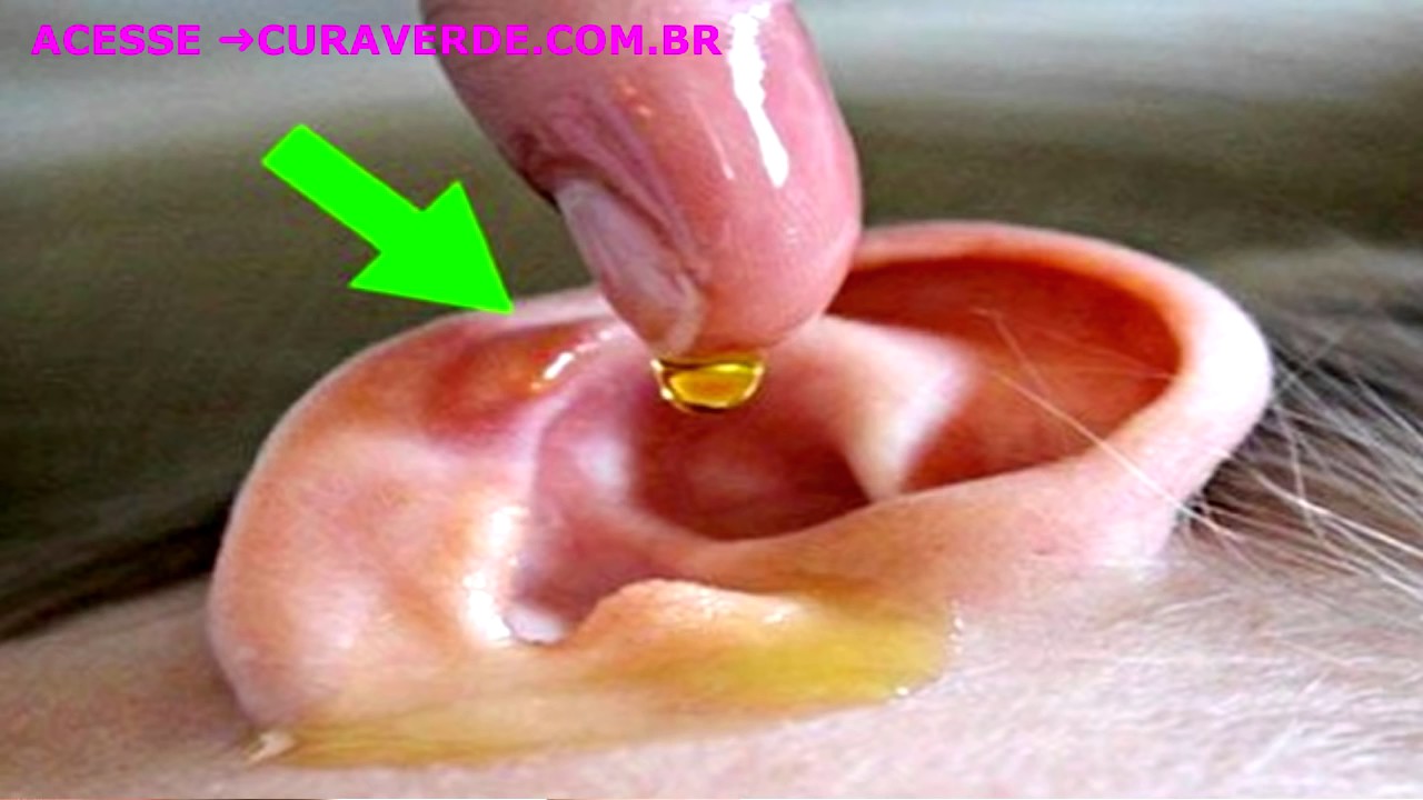 ELIMINE Toda CERA DO OUVIDO e Volte a ESCUTAR Como Criança em 2 Minutos Veja Como é Fácil YouTube ELIMINE Toda CERA DO OUVIDO e Volte a ESCUTAR Como Criança em 2 Minutos Veja Como é Fácil YouTube