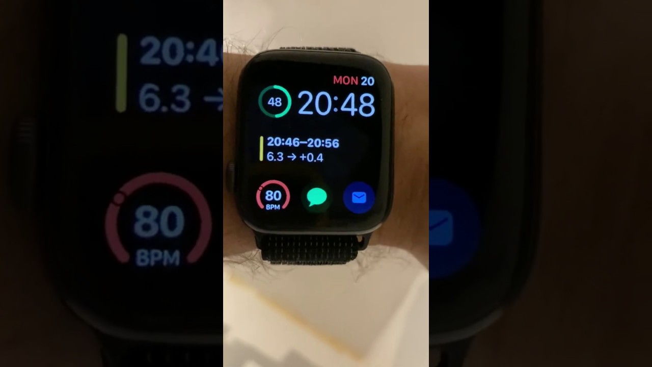 Getting blood glucose with Apple Watch YouTube