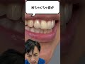 🦷セラミック🦷 #金歯先生 #歯医者 #dentist #歯科医師 #セラミック #shorts