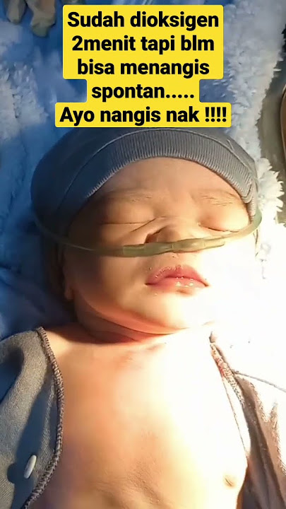 BAYI LAHIR SESAK NAP4S‼️ SUDAH DI OKSIGEN BELUM JUGA BISA MENANGIS SPONTAN