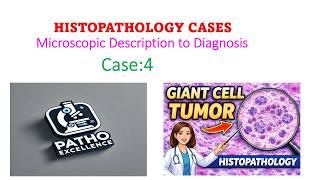 Case 4 Giant Cell Tumor Bone | Microscopy to Diagnosis | Stepwise Pathology Approach