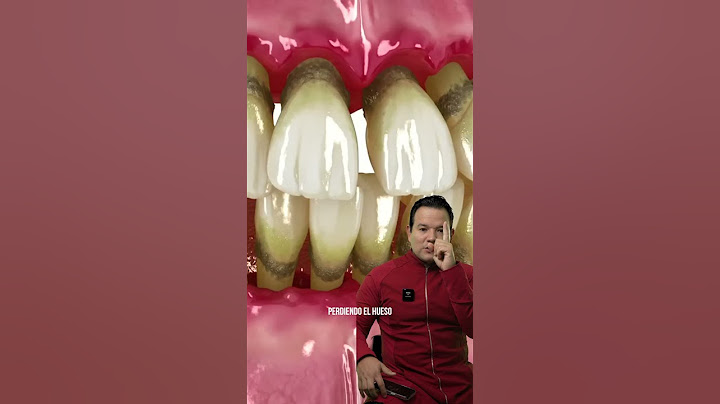 Enfermedad periodontal cuál es la solución?