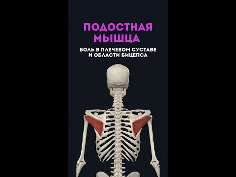 Подостная мышца. Боль